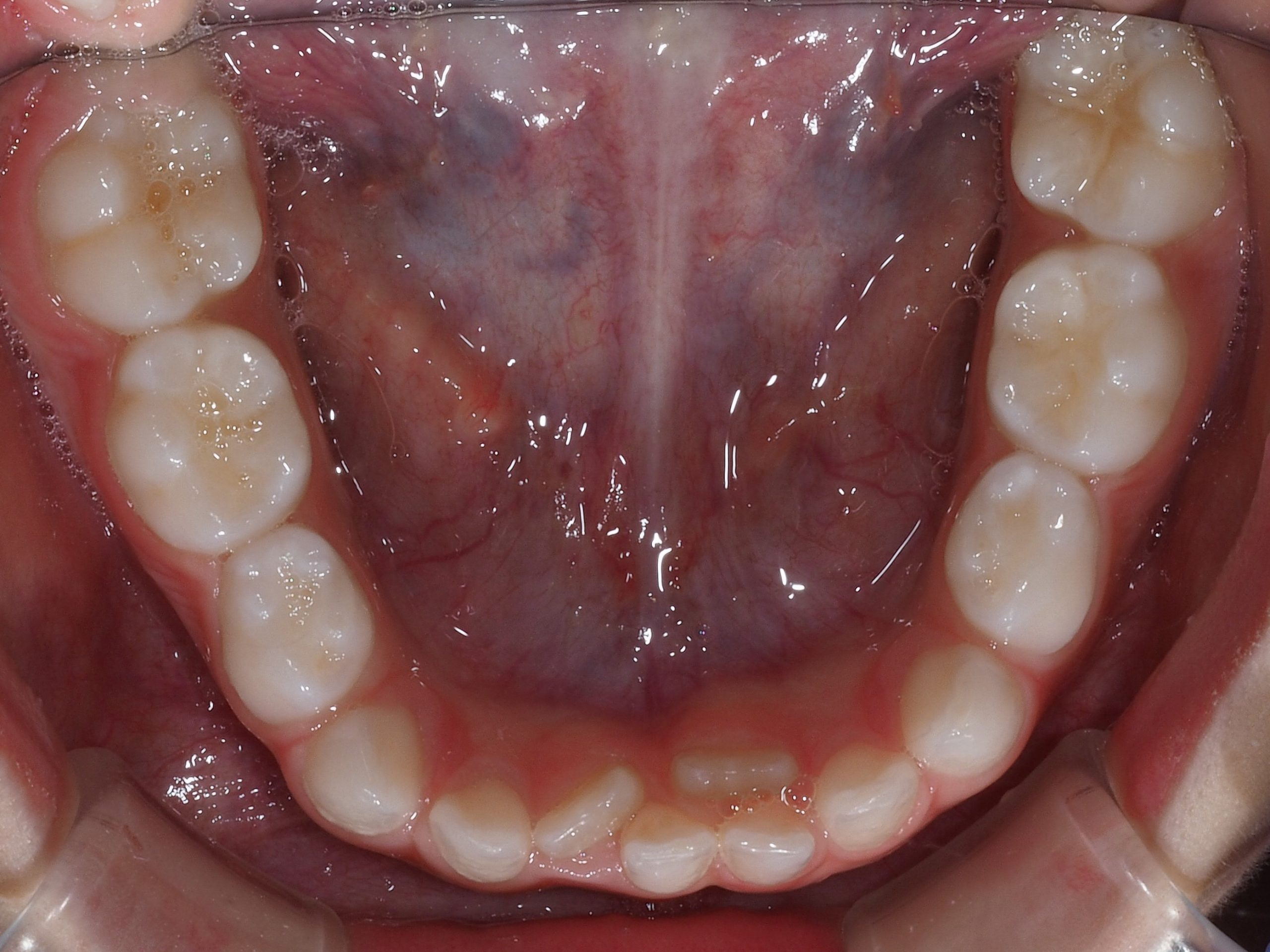 Spazzolino Elettrico