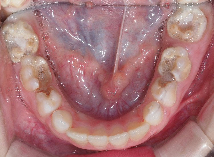 Spazzolino Elettrico