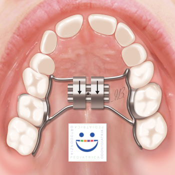 Spazzolino Elettrico