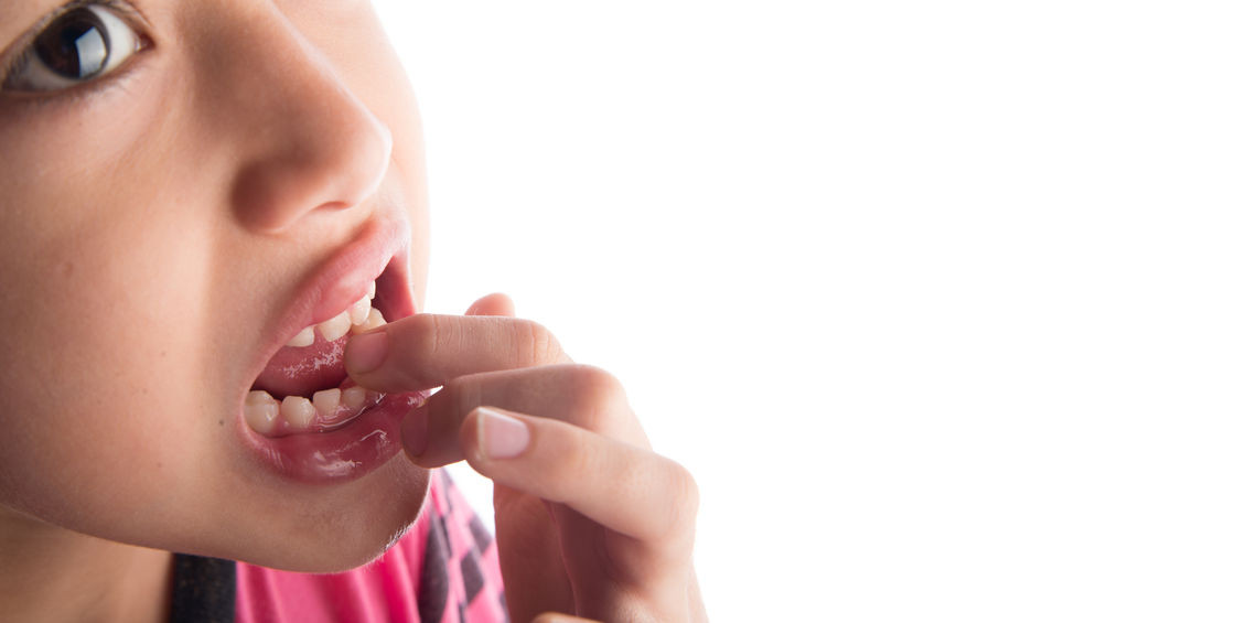 Ricrescita dei denti nei bambini