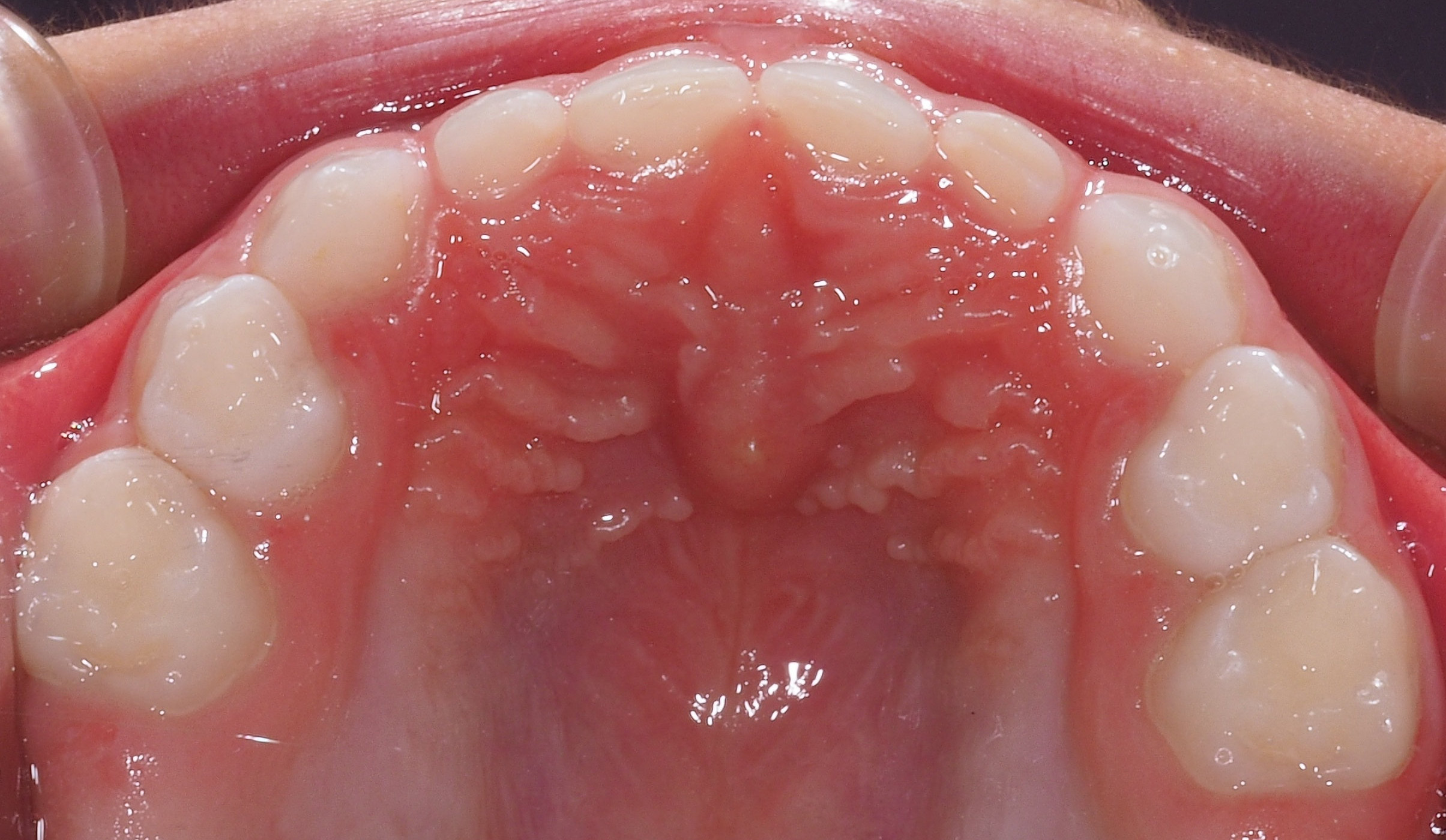 Spazzolino Elettrico