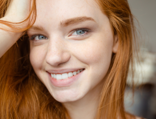 Sbiancamento dei denti professionale